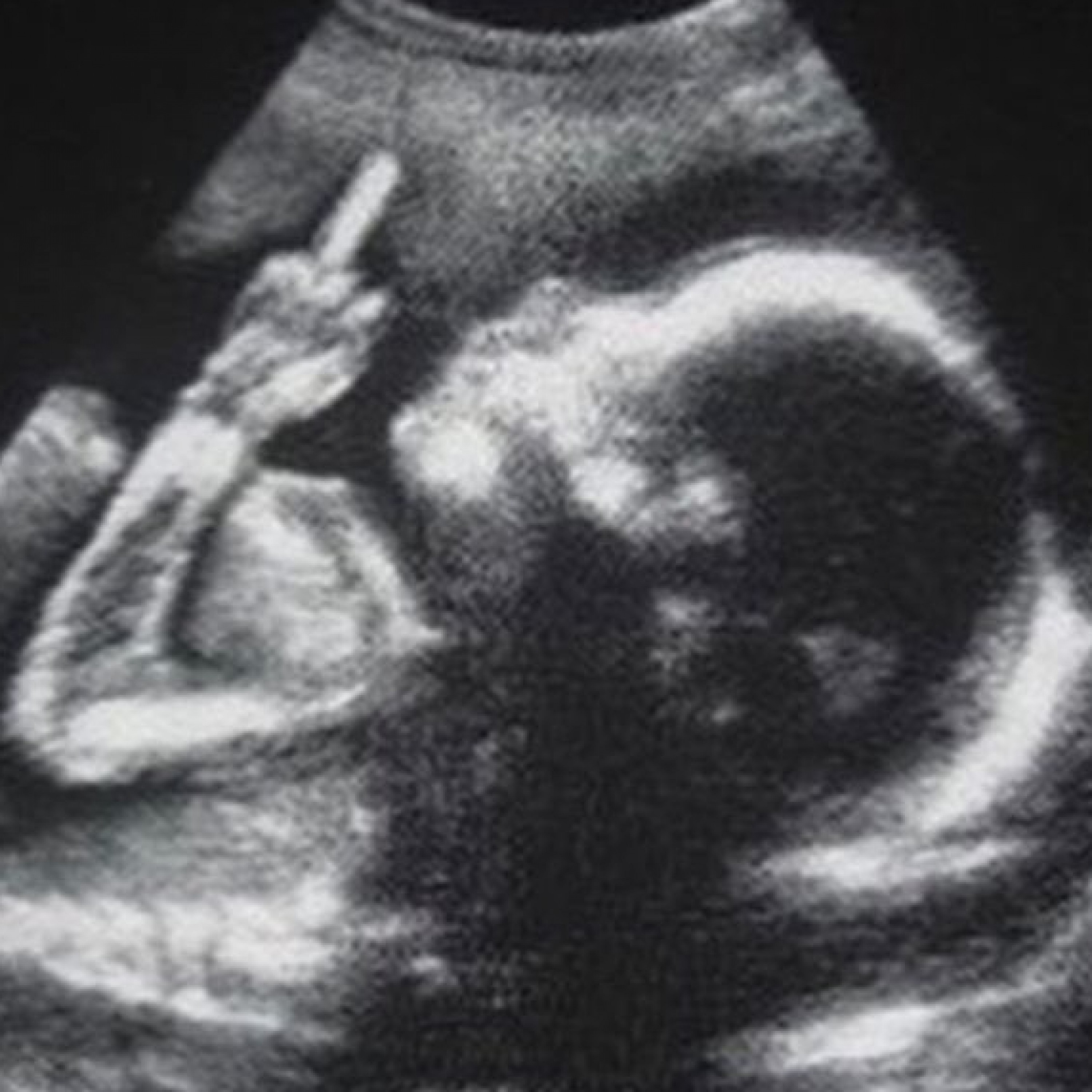 ジャケット写真